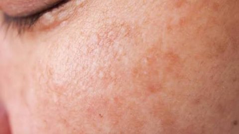 Menopause skin changes and failing skincare routine