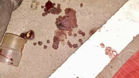 Man Sustained Multiple Injuries in Assault Following Failed Robbery in Amaotana, KwaZulu-Natal