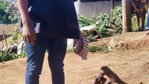 Suspected Electrocution Leaves 33-Year-Old Man Injured in Ebhayi, Flamingo Heights